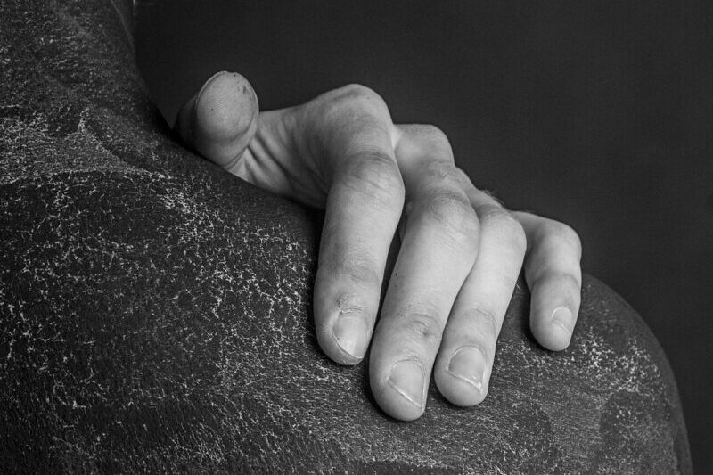 man-3453279_1920 Hand op zwarte, verkoolde huid. De pijn aanraken ofwel in contact komen met de pijn.
