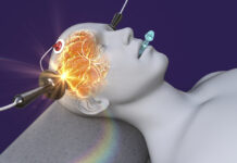 Onderzoek: wat patiënten melden over ECT-schade ECT wordt toegepast, illustratie