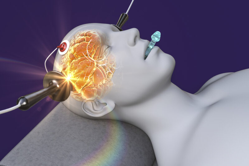 Electroconvulsive therapy, ECT, a treatment involving the use of electrical currents to stimulate the brain, 3D illustration ECT wordt toegepast, illustratie